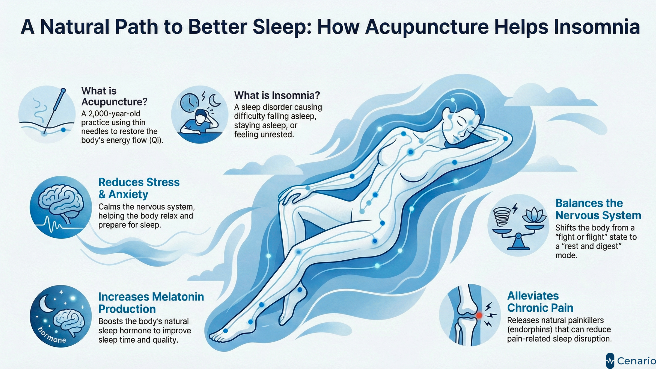 Illustration of acupuncture points improving sleep and reducing insomnia
